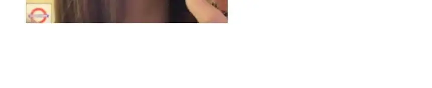 [블러셔증정기획] 로지킴 PDRN 틴티드 립 앰플 10ml 11종 상세페이지 72